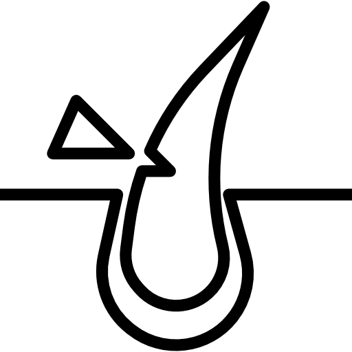 لیزر موهای زائد